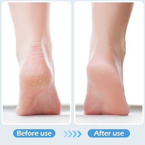 3 Pcs 4-in-1 Foot Scrubber Brush - Image 5