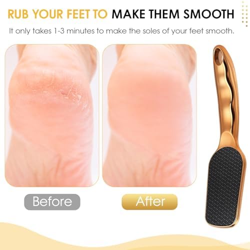 Nano-Glass Foot File Gold, Ergonomic Handle Foot Care Tool - Image 5