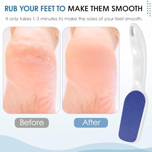Nano-Glass Foot File White, Ergonomic Handle Foot Care Tool - Image 5