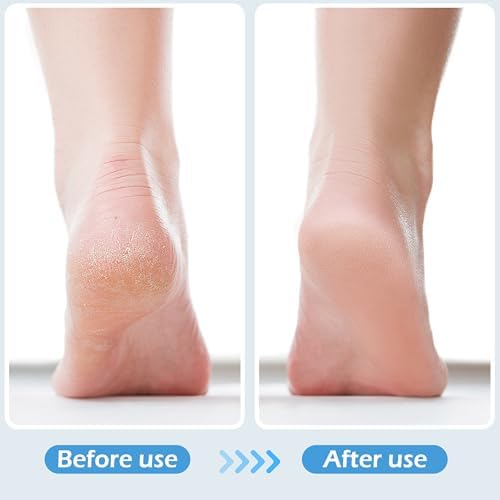 4 in 1 Foot Brush - Image 5