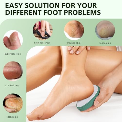 BALUCA Glass Foot File Callus Remover - Image 2
