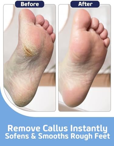 Glass Foot File Callus Remover - Image 4