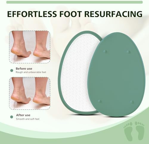 BALUCA Glass Foot File Callus Remover - Image 3