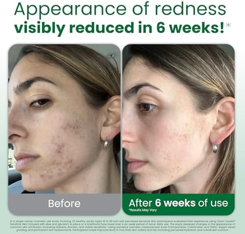 CLEAN SKIN CLUB Sensitive Skin Clean Towels® XL, Ultra-Soft Disposable Face Dry - Image 2